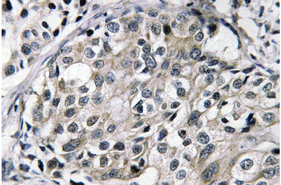 Immunohistochemistry - Anti-TAT Antibody (R12-2376) - Antibodies.com
