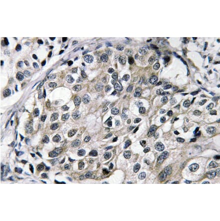 Immunohistochemistry - Anti-TAT Antibody (R12-2376) - Antibodies.com