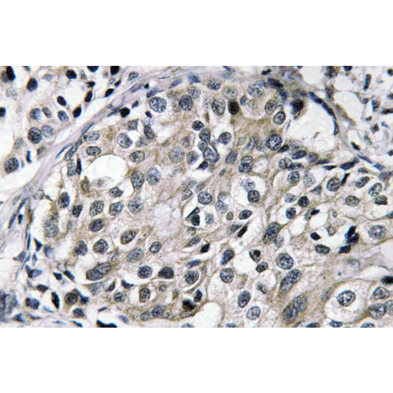 Immunohistochemistry - Anti-TAT Antibody (R12-2376) - Antibodies.com