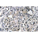 Immunohistochemistry - Anti-TAT Antibody (R12-2376) - Antibodies.com