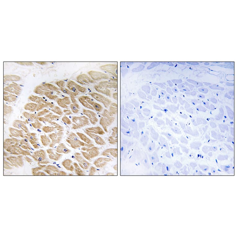 Immunohistochemistry - Anti-MIA Antibody (C16607) - Antibodies.com