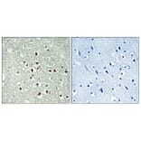 Immunohistochemistry - Anti-MAX Antibody (B1096) - Antibodies.com