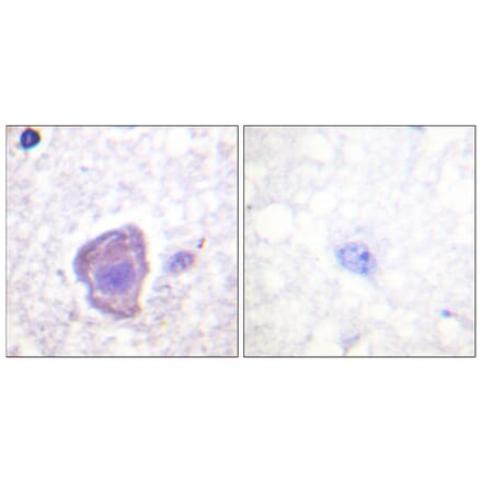Immunohistochemistry - Anti-FAK Antibody (B0924) - Antibodies.com