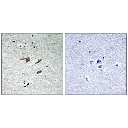Immunohistochemistry - Anti-FAK Antibody (B8033) - Antibodies.com