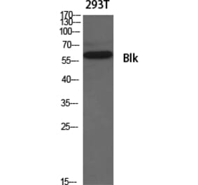 Western Blot - Anti-BLK Antibody (B8081) - Antibodies.com