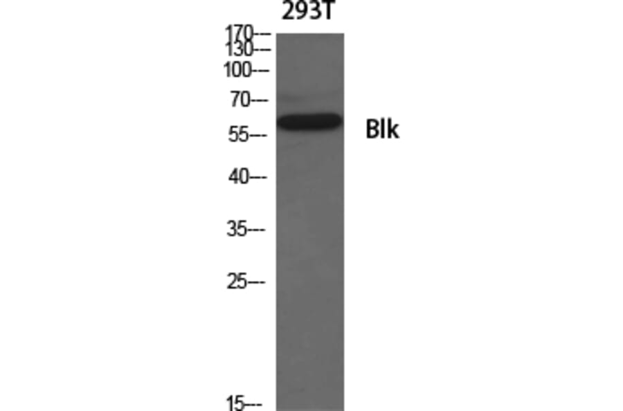 Western Blot - Anti-BLK Antibody (B8081) - Antibodies.com