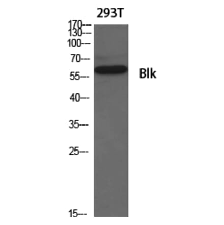 Western Blot - Anti-BLK Antibody (B8081) - Antibodies.com