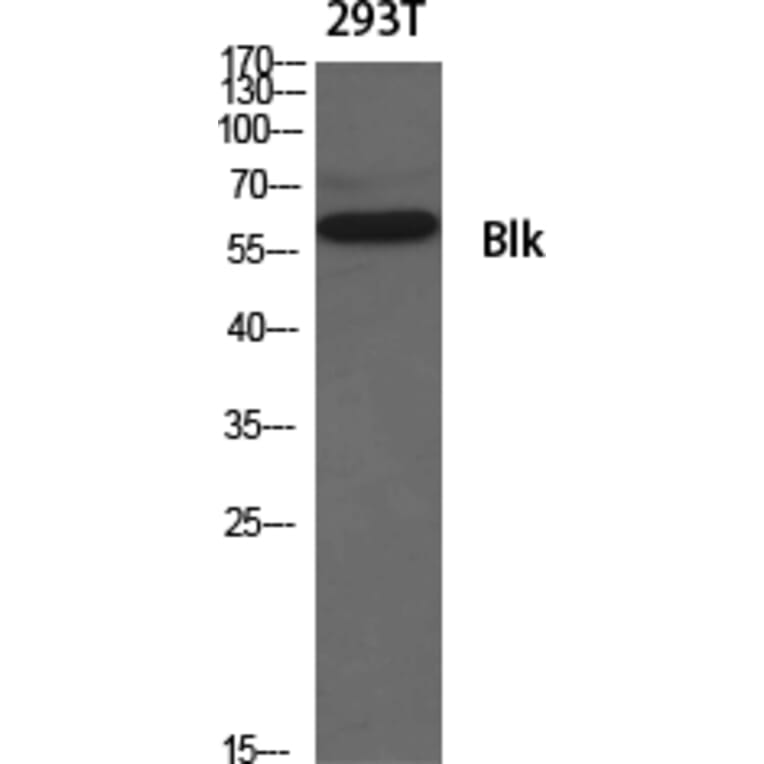 Western Blot - Anti-BLK Antibody (B8081) - Antibodies.com