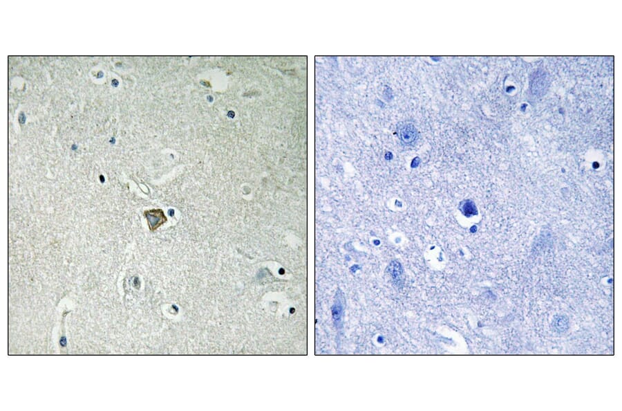 Immunohistochemistry - Anti-Bax Antibody (B8297) - Antibodies.com