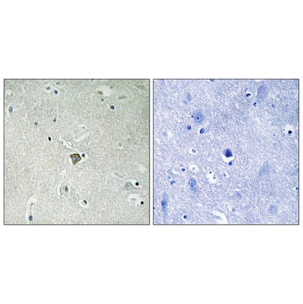 Immunohistochemistry - Anti-Bax Antibody (B8297) - Antibodies.com