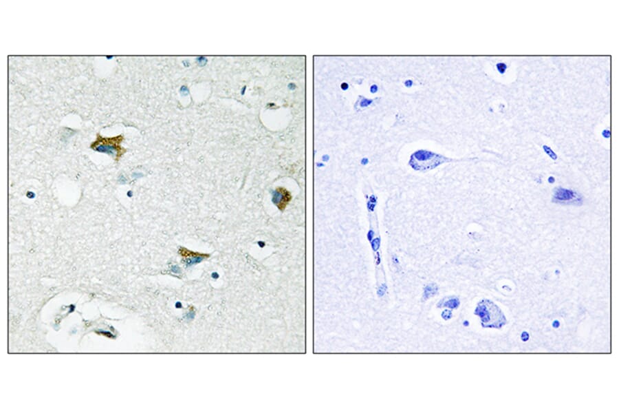 Immunohistochemistry - Anti-BAD Antibody (B0821) - Antibodies.com