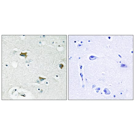 Immunohistochemistry - Anti-BAD Antibody (B0821) - Antibodies.com