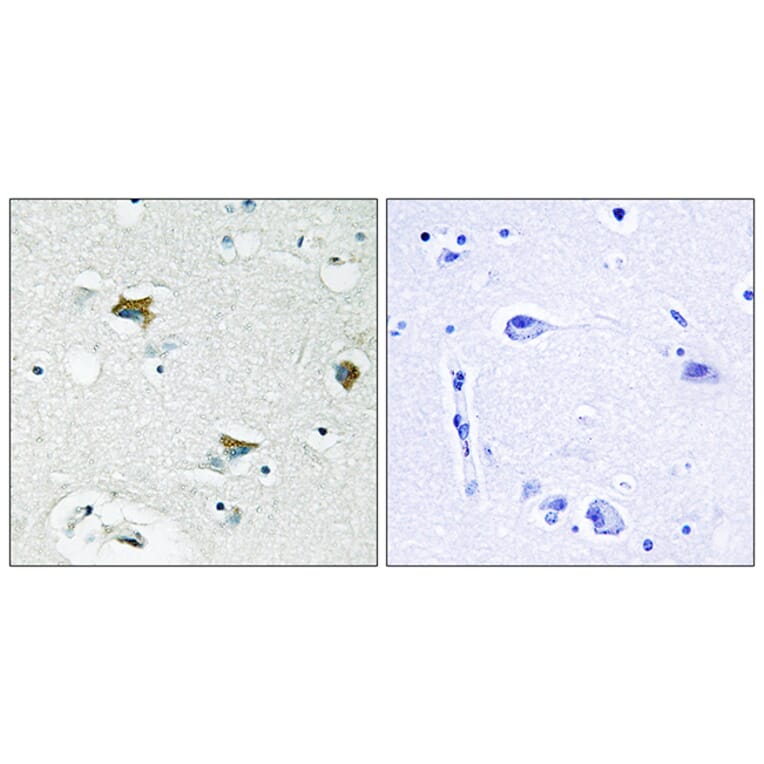 Immunohistochemistry - Anti-BAD Antibody (B0821) - Antibodies.com