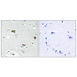 Immunohistochemistry - Anti-BAD Antibody (B0821) - Antibodies.com