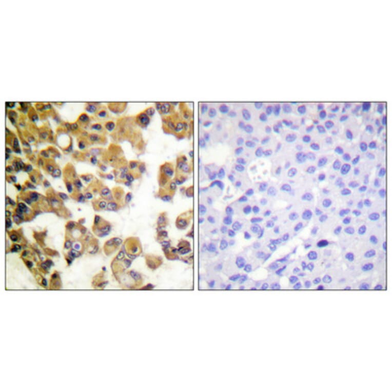 Immunohistochemistry - Anti-BAD Antibody (B0821) - Antibodies.com