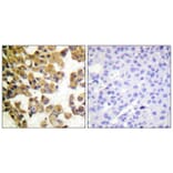 Immunohistochemistry - Anti-BAD Antibody (B0821) - Antibodies.com