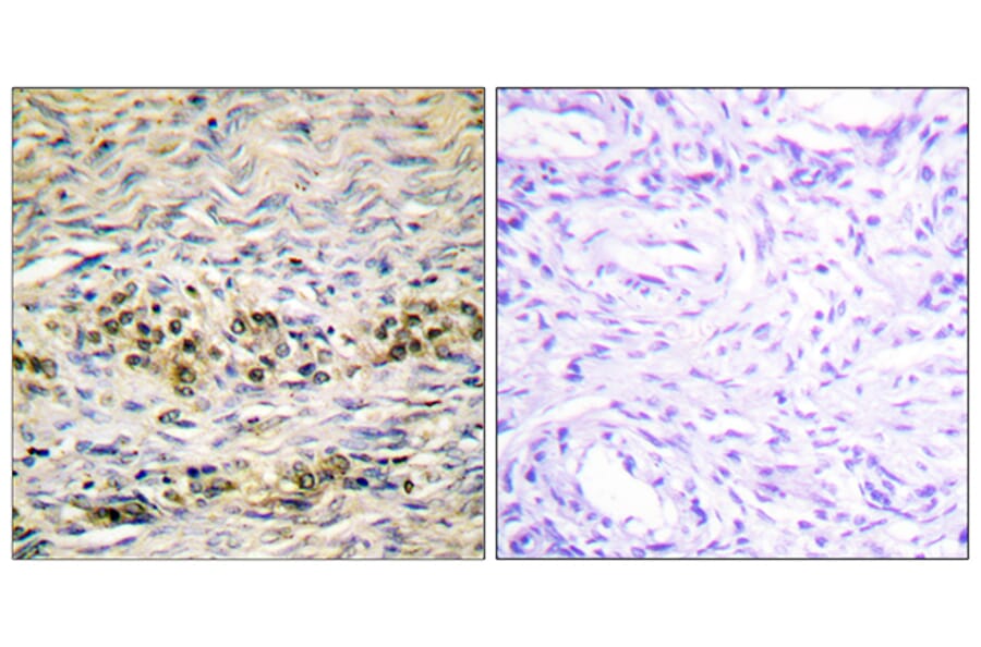 Immunohistochemistry - Anti-Akt Antibody (B0607) - Antibodies.com