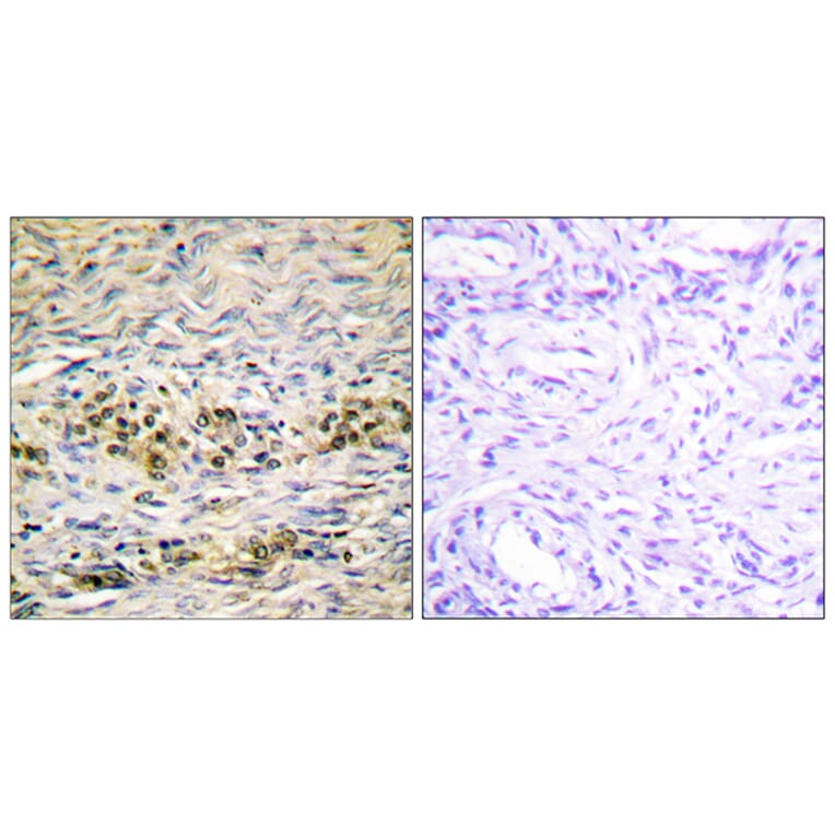 Immunohistochemistry - Anti-Akt Antibody (B0607) - Antibodies.com