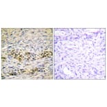 Immunohistochemistry - Anti-Akt Antibody (B0607) - Antibodies.com