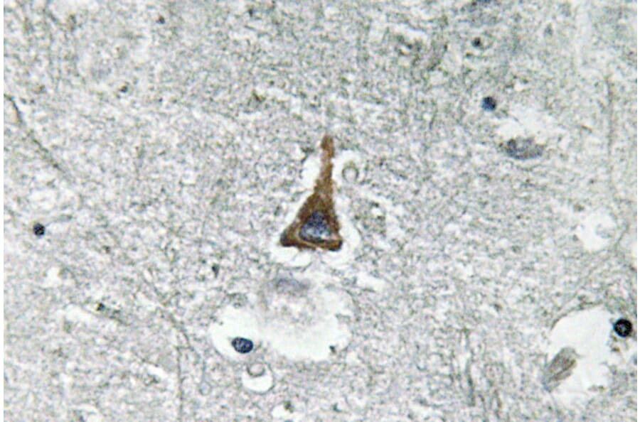 Immunohistochemistry - Anti-ADM Antibody (R12-2014) - Antibodies.com