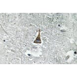 Immunohistochemistry - Anti-ADM Antibody (R12-2014) - Antibodies.com