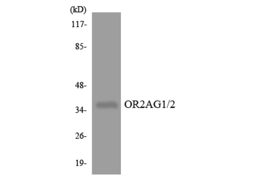Western Blot - Anti-OR2AG1 + OR2AG2 Antibody (R12-3160) - Antibodies.com