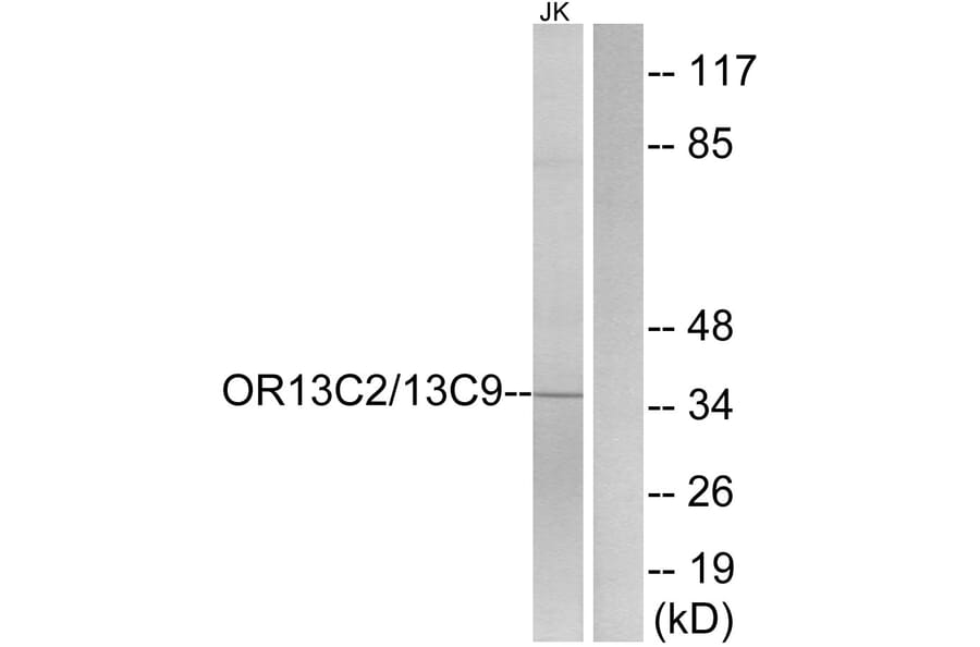 Western Blot - Anti-OR13C2 + OR13C9 Antibody (G838) - Antibodies.com