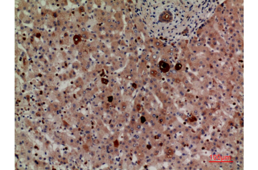Immunohistochemistry - Anti-LILRA2 + LILRA3 Antibody (C30390) - Antibodies.com