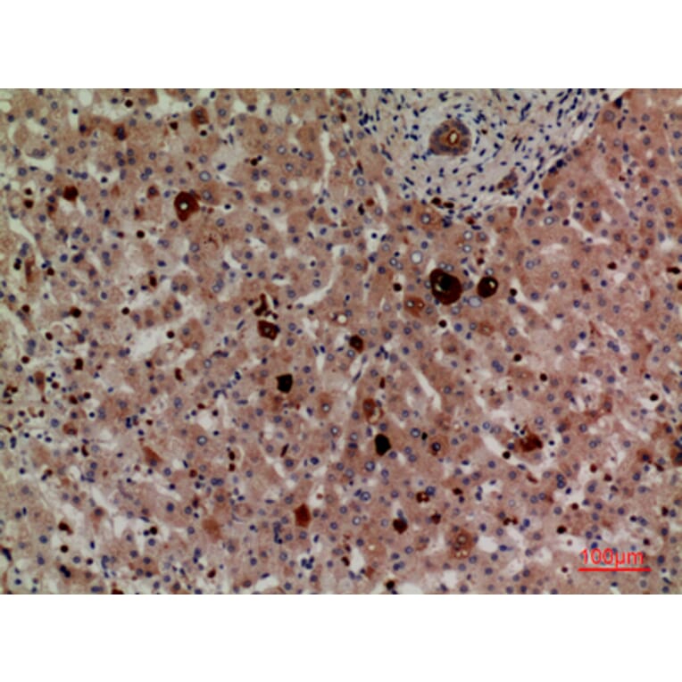 Immunohistochemistry - Anti-LILRA2 + LILRA3 Antibody (C30390) - Antibodies.com