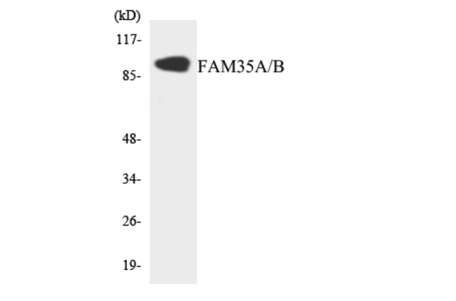 Western Blot - Anti-FAM35A + FAM35B Antibody (R12-2765) - Antibodies.com