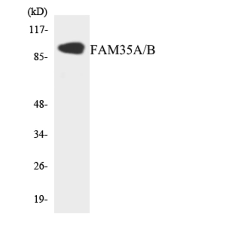 Western Blot - Anti-FAM35A + FAM35B Antibody (R12-2765) - Antibodies.com