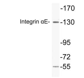 Western Blot - Anti-Integrin alphaE Antibody (R12-2221) - Antibodies.com