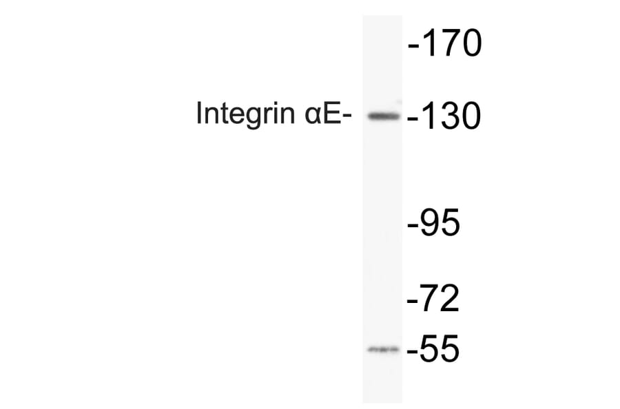 Western Blot - Anti-Integrin alphaE Antibody (R12-2221) - Antibodies.com