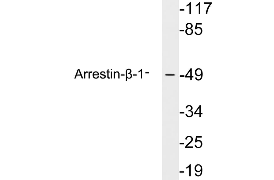 Western Blot - Anti-Arrestin-beta-1 Antibody (R12-2030) - Antibodies.com