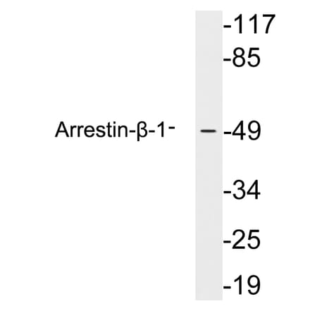 Western Blot - Anti-Arrestin-beta-1 Antibody (R12-2030) - Antibodies.com