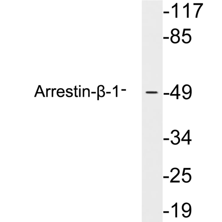Western Blot - Anti-Arrestin-beta-1 Antibody (R12-2030) - Antibodies.com