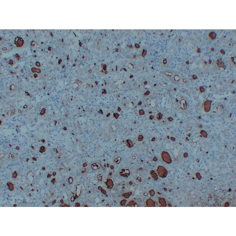 Immunohistochemistry - Anti-Thyroglobulin Antibody (V0131) - Antibodies.com