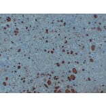 Immunohistochemistry - Anti-Thyroglobulin Antibody (V0131) - Antibodies.com