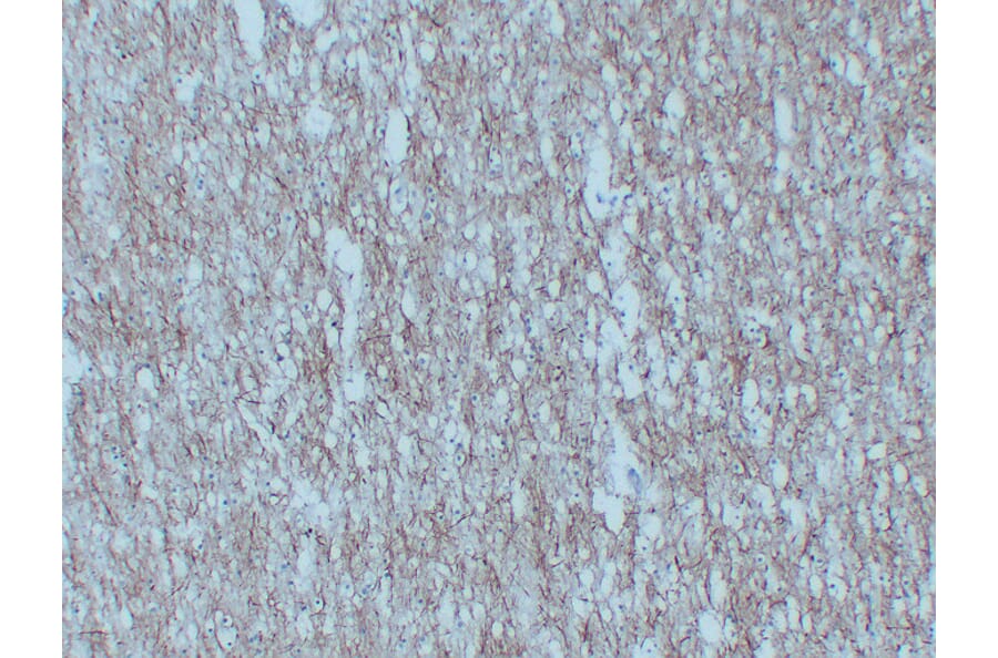 Immunohistochemistry - Anti-Neurofilament Antibody (V0103) - Antibodies.com
