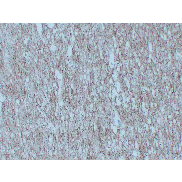 Immunohistochemistry - Anti-Neurofilament Antibody (V0103) - Antibodies.com