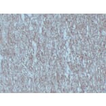 Immunohistochemistry - Anti-Neurofilament Antibody (V0103) - Antibodies.com