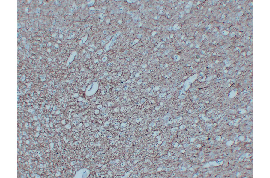 Immunohistochemistry - Anti-Neurofilament Antibody (V0103) - Antibodies.com