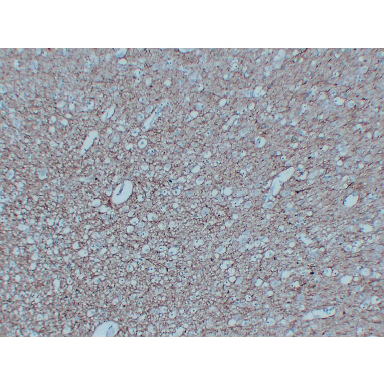 Immunohistochemistry - Anti-Neurofilament Antibody (V0103) - Antibodies.com