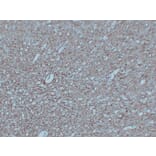 Immunohistochemistry - Anti-Neurofilament Antibody (V0103) - Antibodies.com