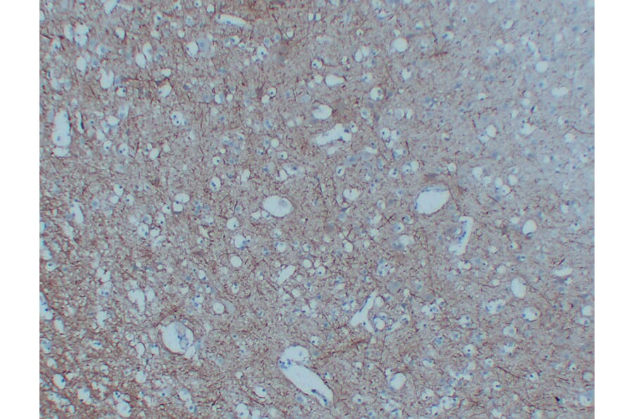 Immunohistochemistry - Anti-Neurofilament Antibody (V0103) - Antibodies.com