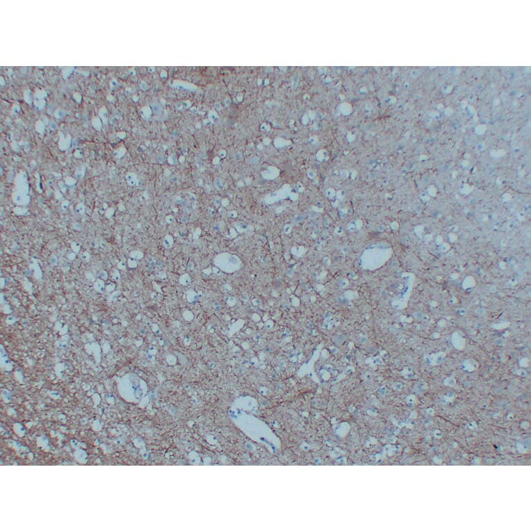 Immunohistochemistry - Anti-Neurofilament Antibody (V0103) - Antibodies.com