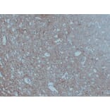 Immunohistochemistry - Anti-Neurofilament Antibody (V0103) - Antibodies.com