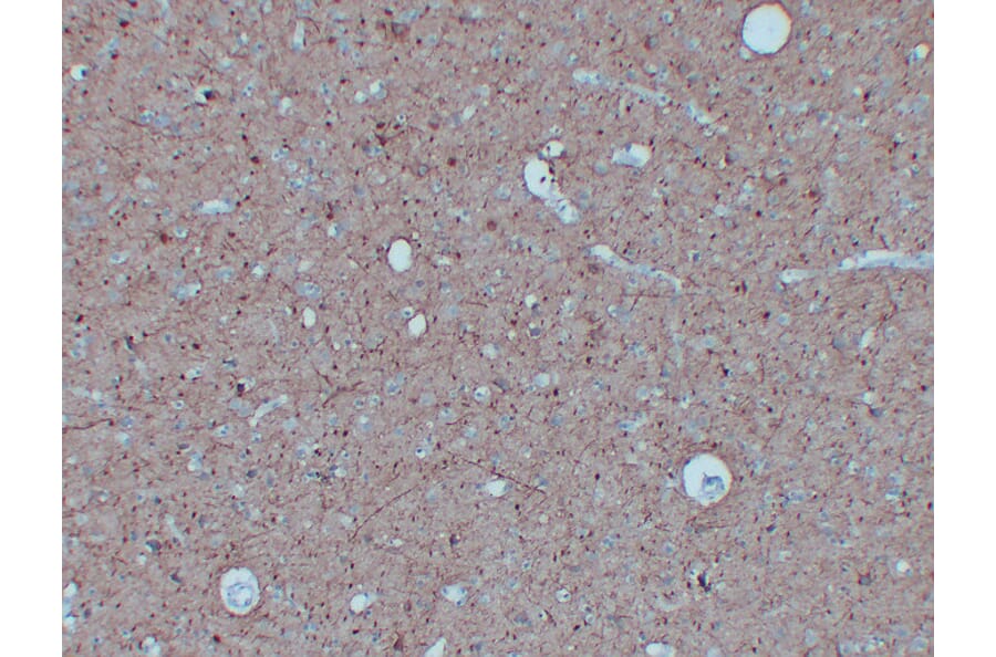 Immunohistochemistry - Anti-Neurofilament Antibody (V0103) - Antibodies.com