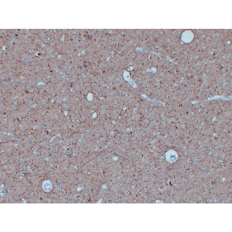 Immunohistochemistry - Anti-Neurofilament Antibody (V0103) - Antibodies.com