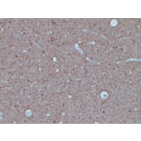 Immunohistochemistry - Anti-Neurofilament Antibody (V0103) - Antibodies.com